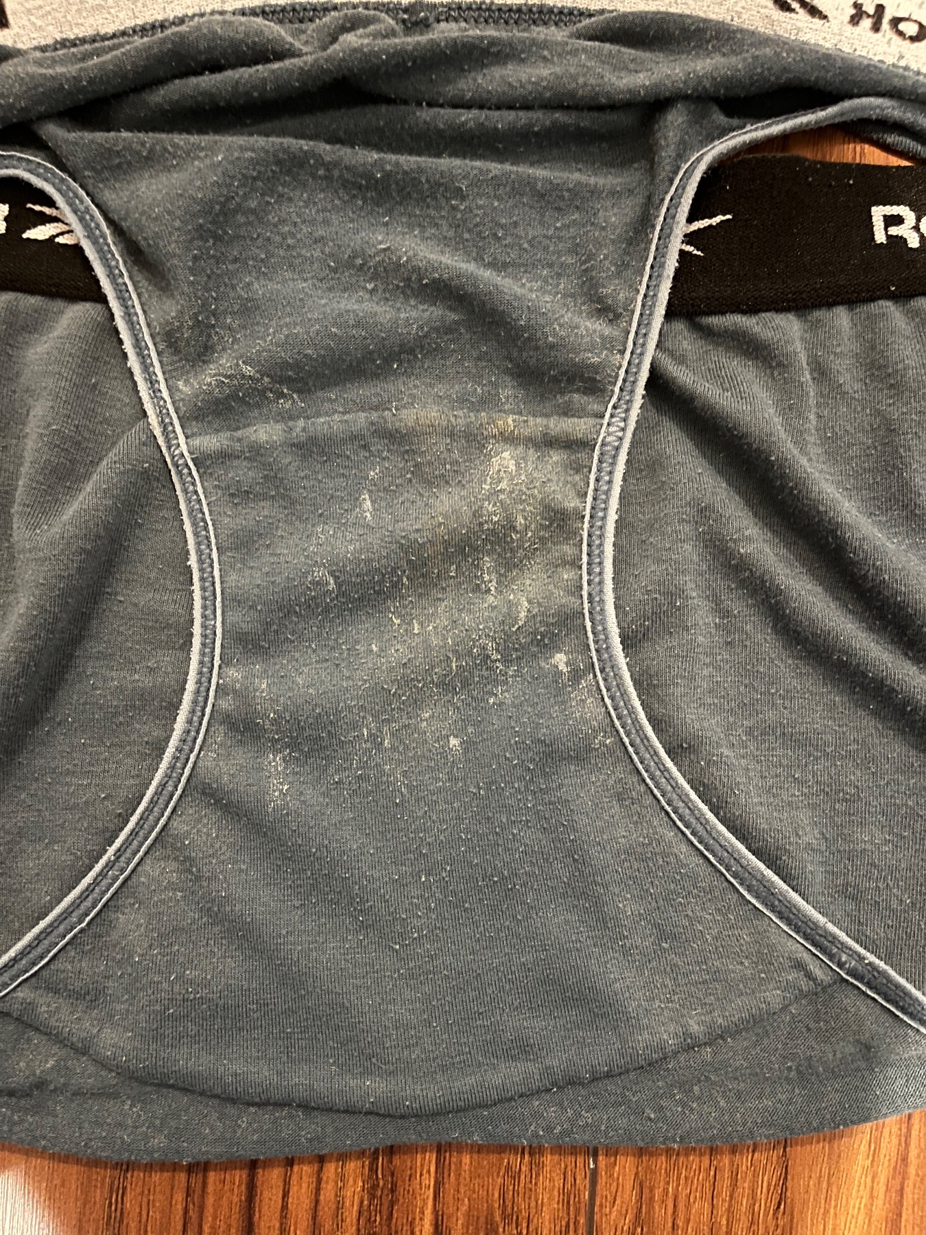 この汚れは何の汚れだと思いますの画像その2