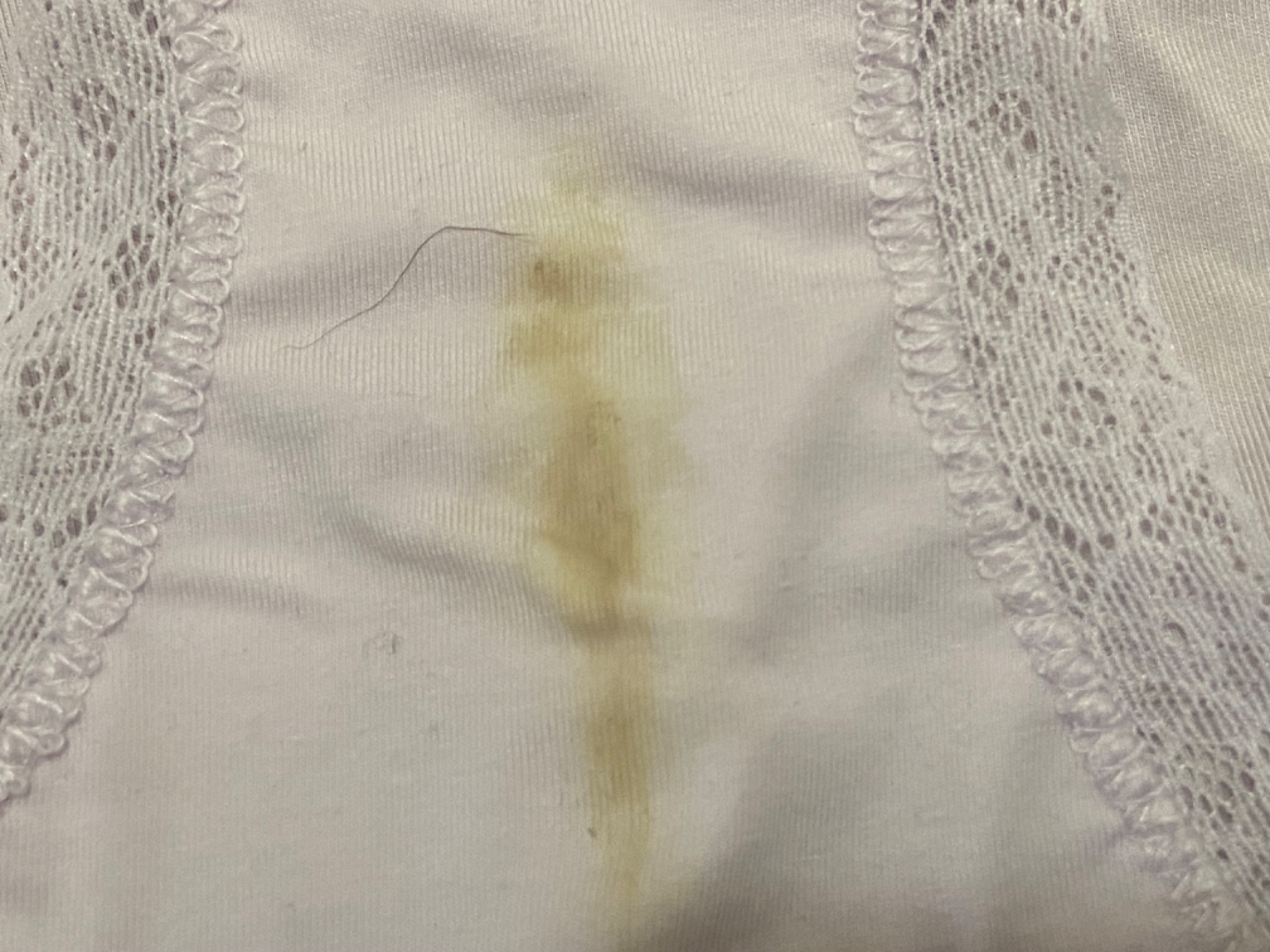 今日もシミ出しの画像その3