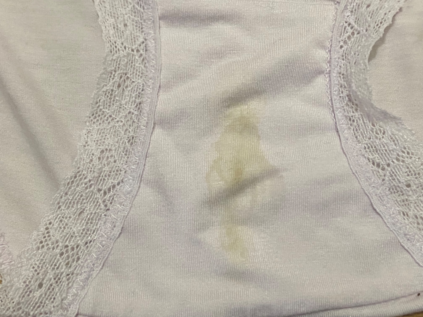 今日もシミ出しの画像その2