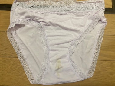 今日もシミ出し