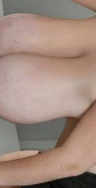 だらしなく垂れ下がったウシ乳