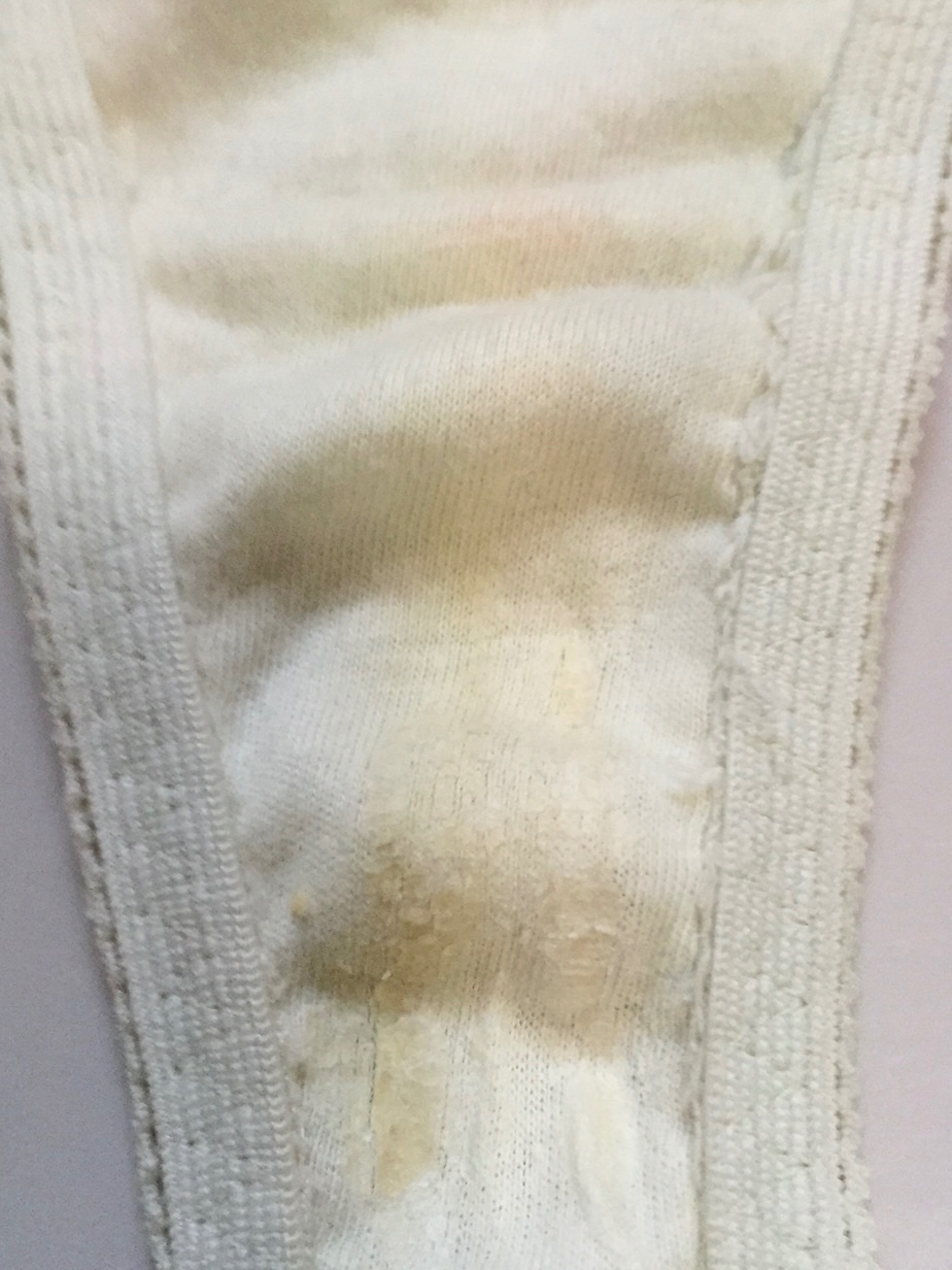 珍しい汚れ…の画像その3