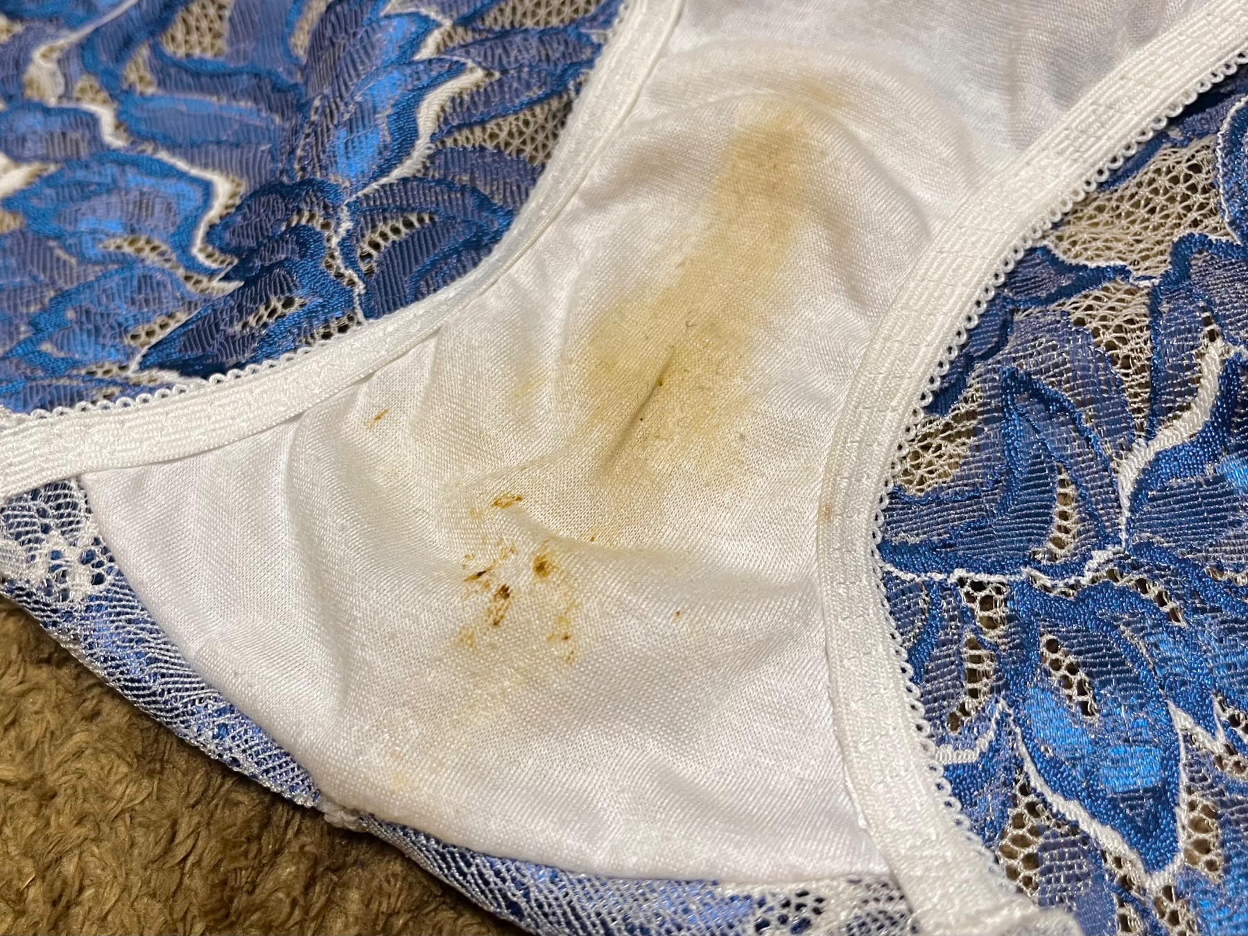 カッピカピの画像その3