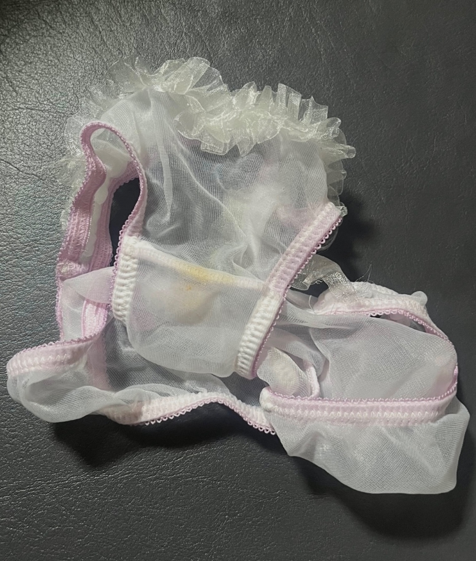 尿じみ ⁇の画像その3