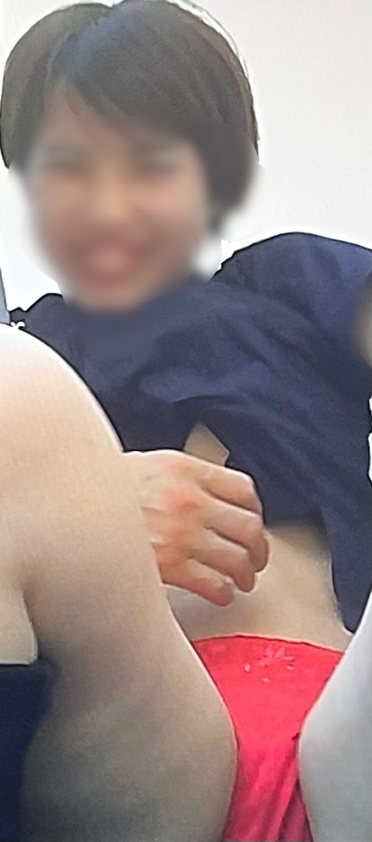 晒したいの画像その1