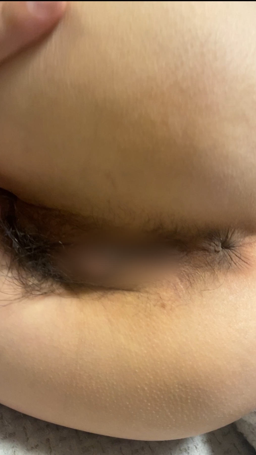 剛毛とア◯ルの画像その3