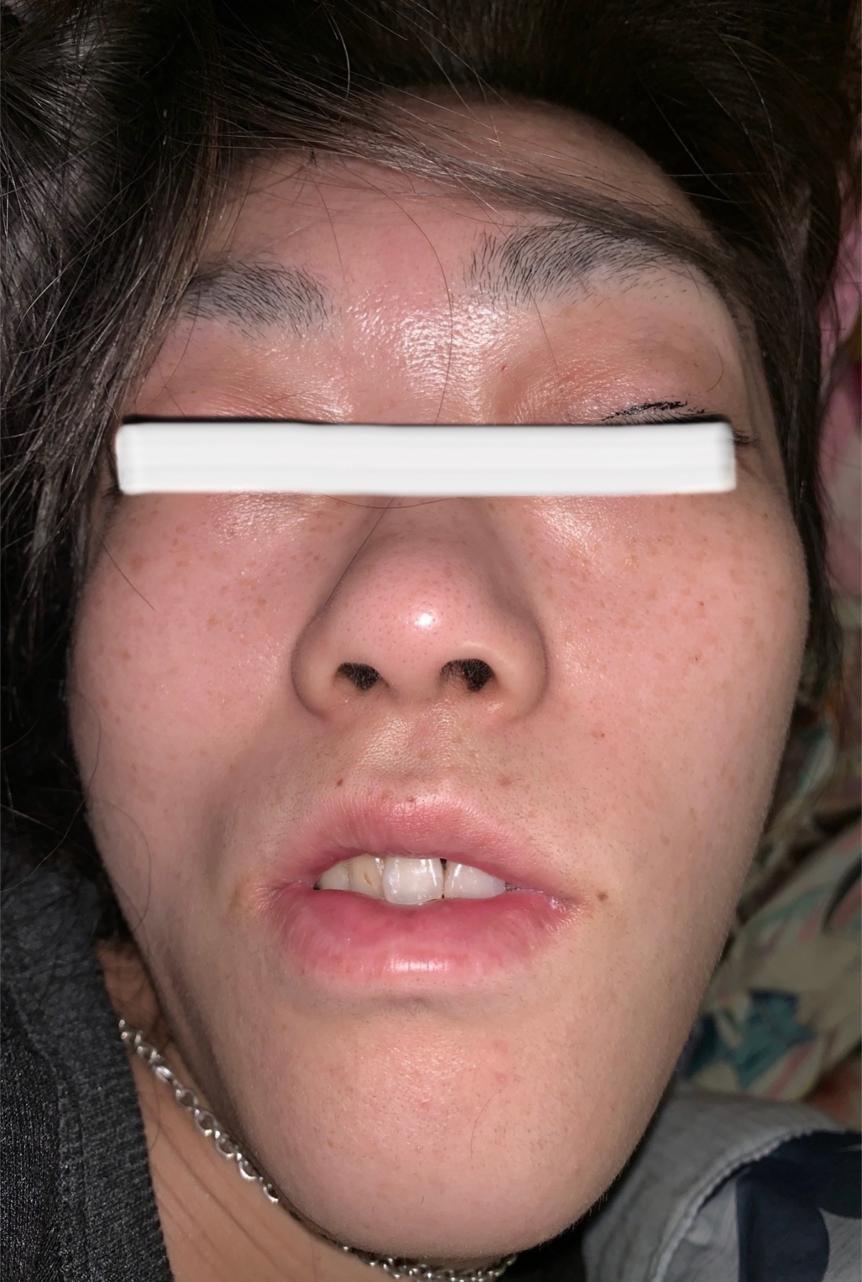 閲覧注意の画像その3