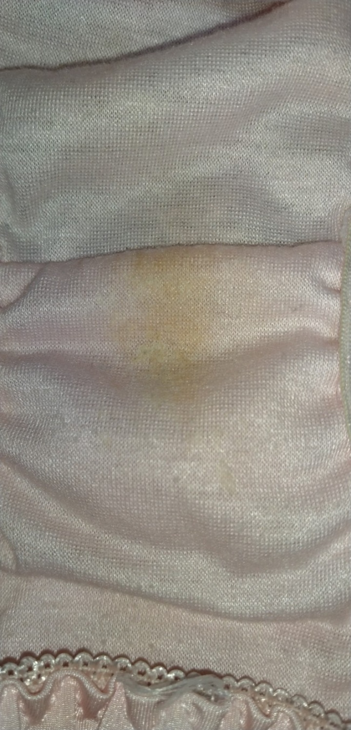 妻の黄色い染みの画像その4