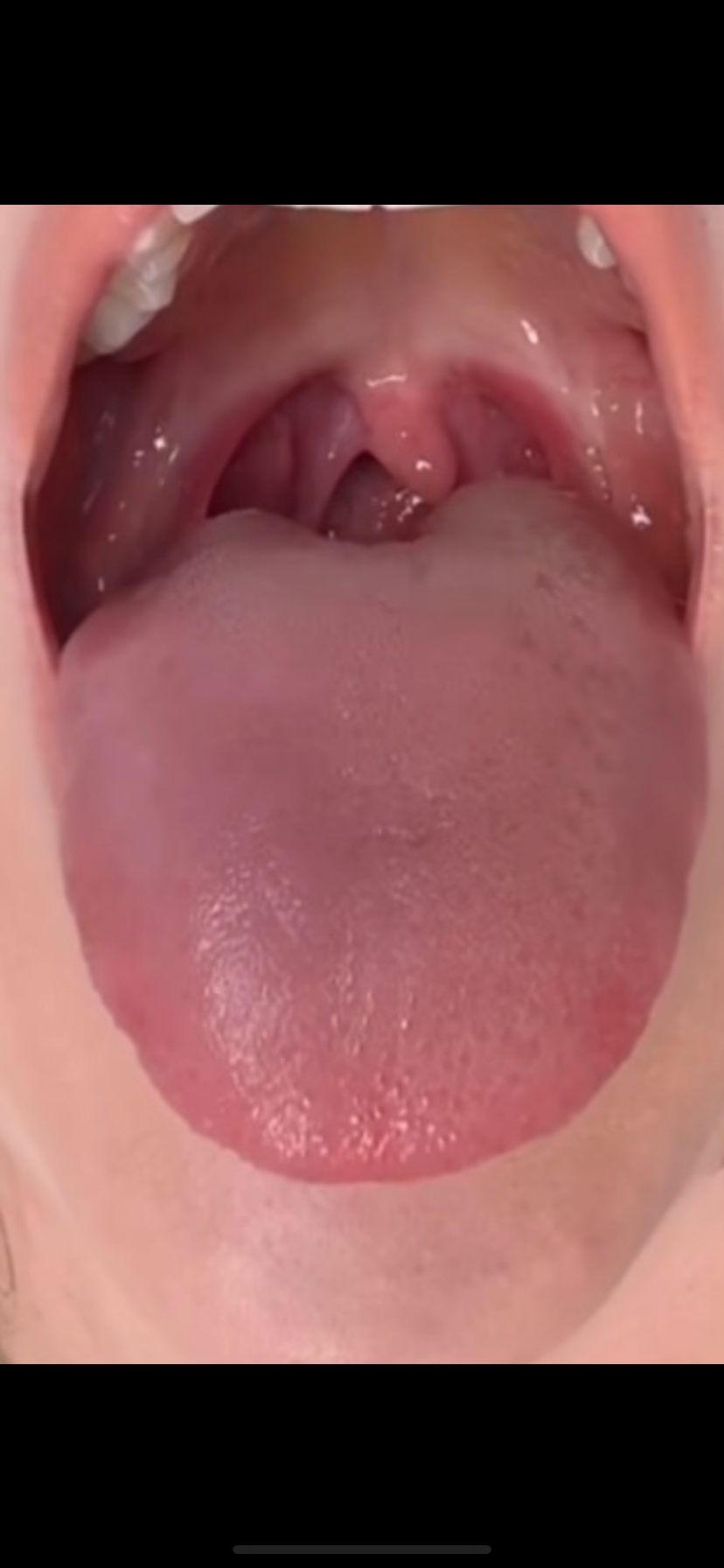 どうしたいの画像その3