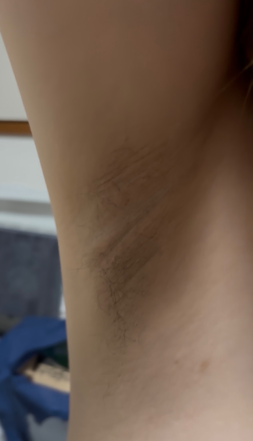 月終わりの脇毛・腋臭チェックの画像その3