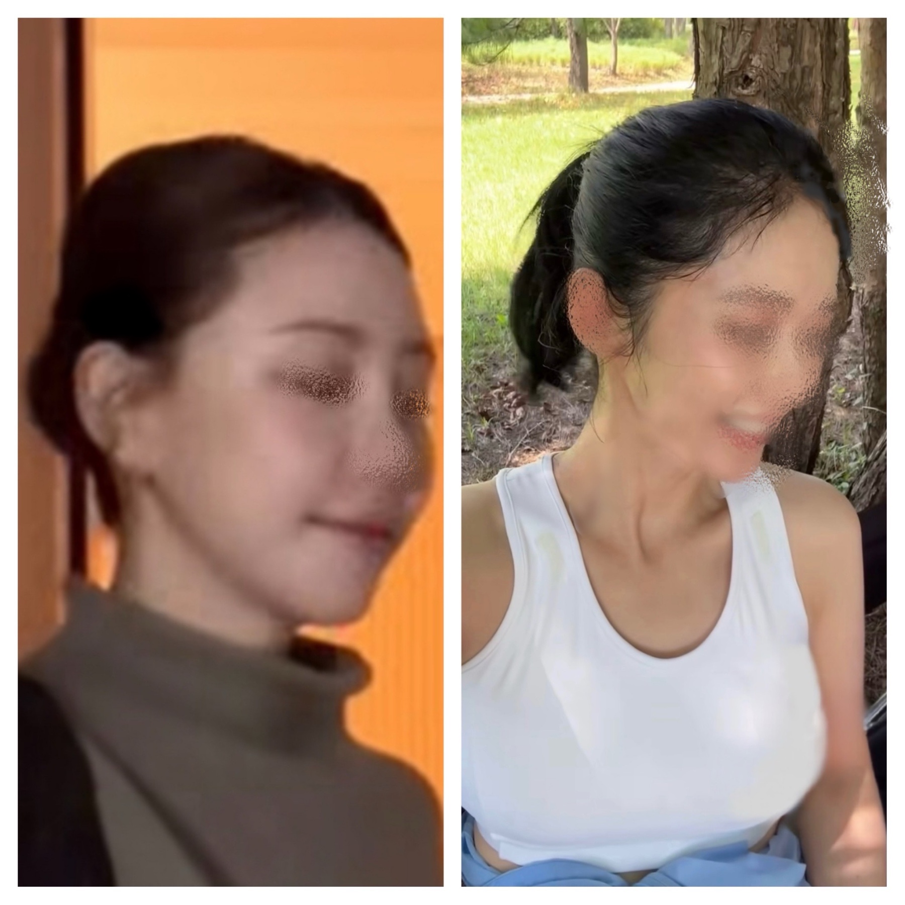 セミTバックの汚れの画像その1