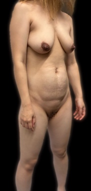 久々の投稿です。