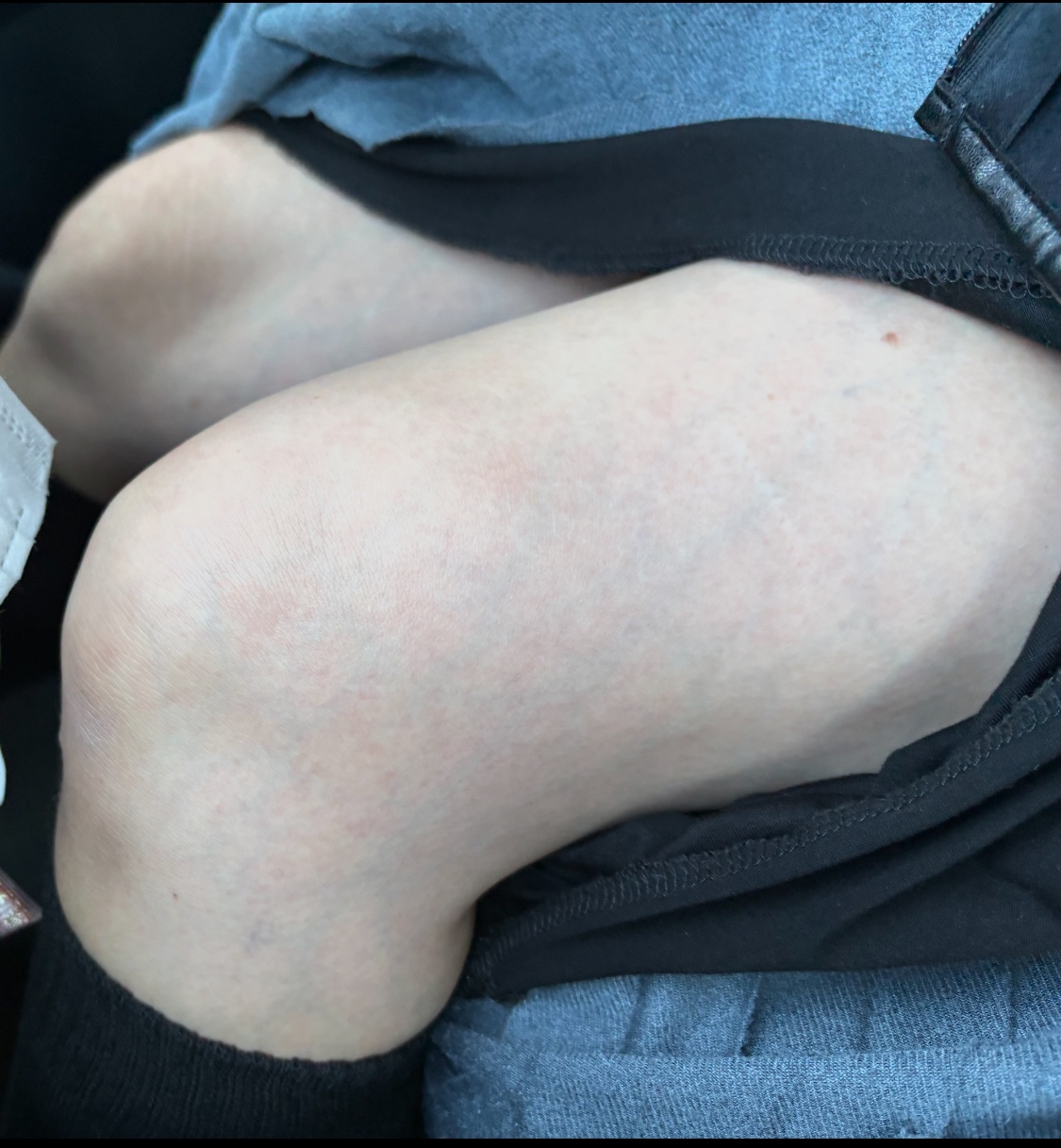 妻のふとももの画像その1