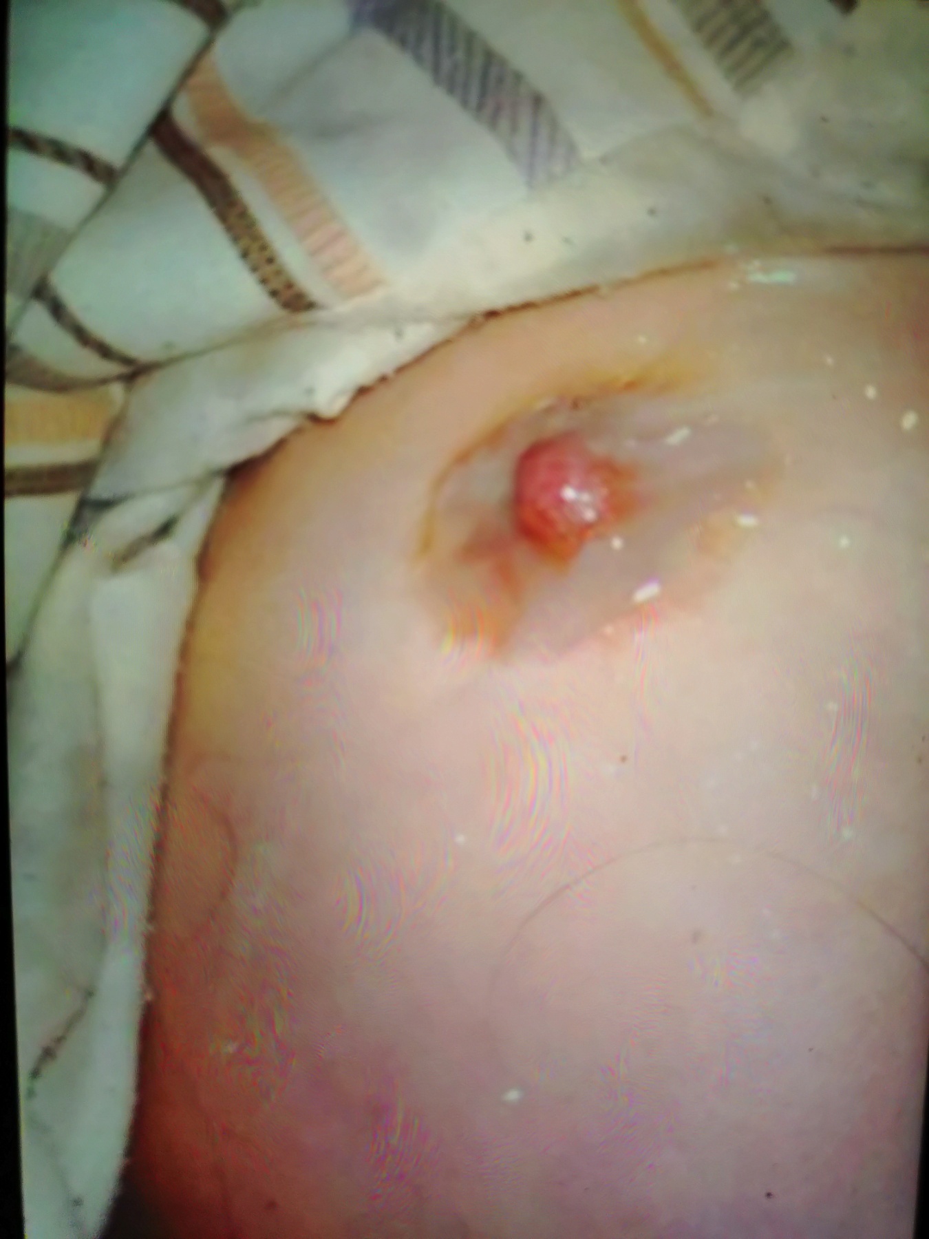 嫁の乳の画像その2