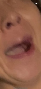 アラフォー口フェチ