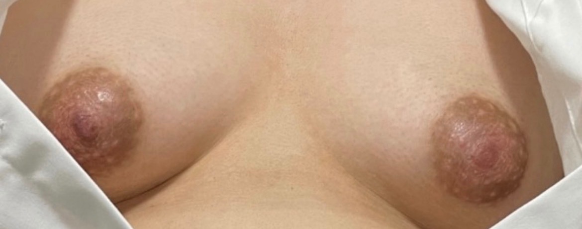 ぽっちゃりの画像その1